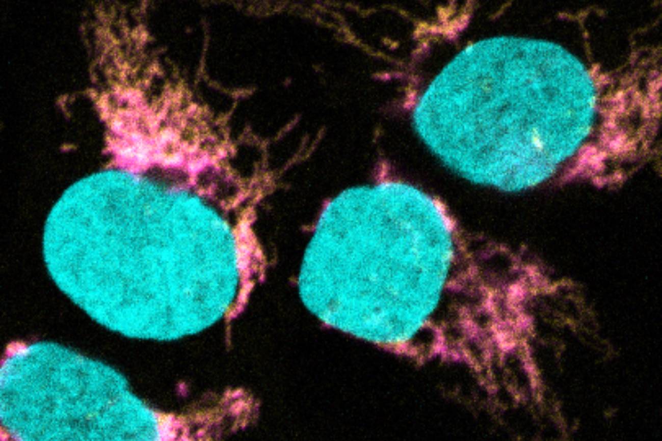 Metabolismo celular: cómo tu cuerpo convierte alimentos en energía